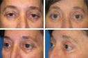 Before & After Photos
